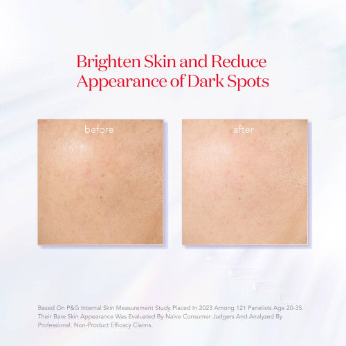 SK‑II GenOptics InfinitAura Serum skin brightening transformation results