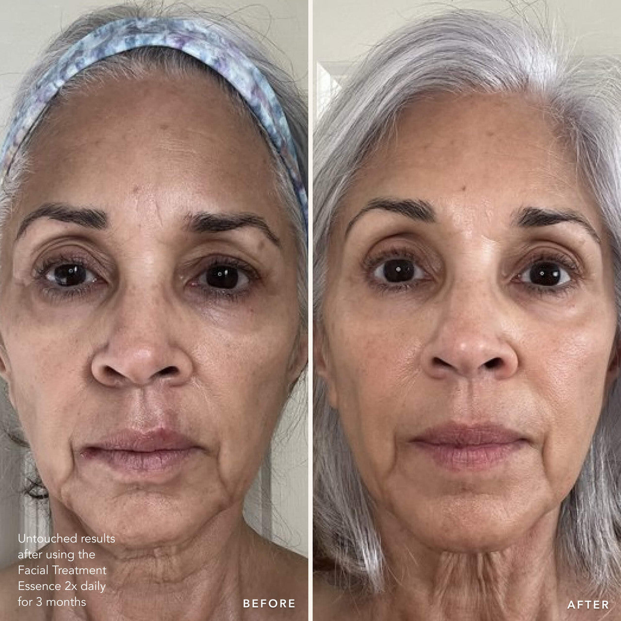 SK-II before and after showing untouched results after using Facial Treatment Essence 2x daily for 3 months