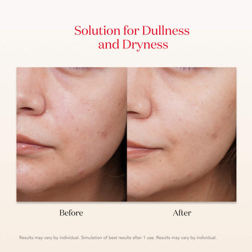 Before and after comparison of skin dullness and dryness solution on a person's face.
