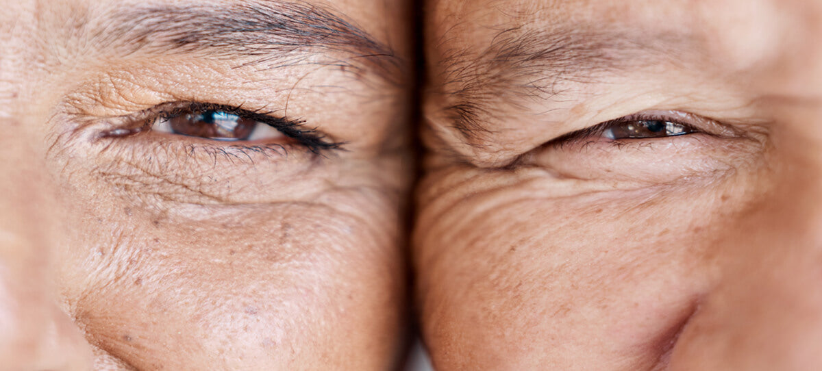Close‑up comparison of two facial eye areas placed side by side, showing visible fine lines and skin texture