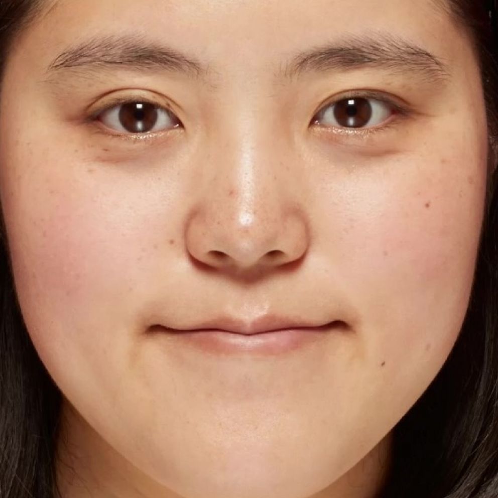 Close-up of a face with clearer, smoother skin texture and more even tone after skincare routine