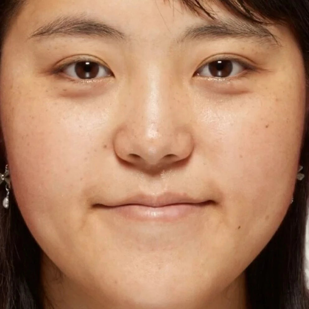 Close-up of a face showing visible pores, uneven skin texture, and spots before skincare routine