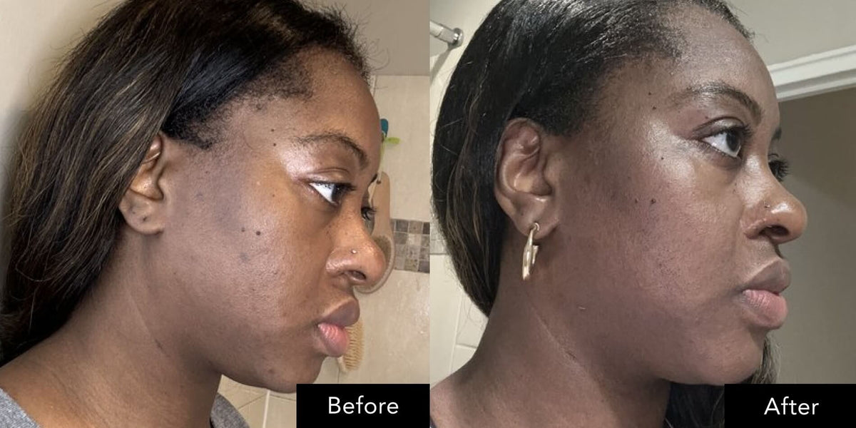 Before and after side profile images showing facial appearance using SK‑II Pitera Ultimate Aura Essentials Kit.
 