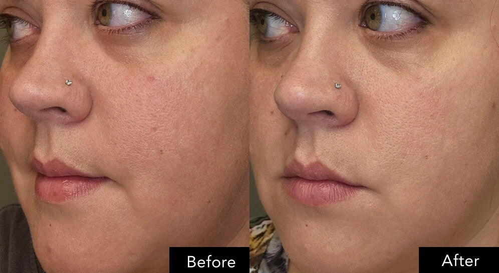 Before and after skin radiance results with SK‑II