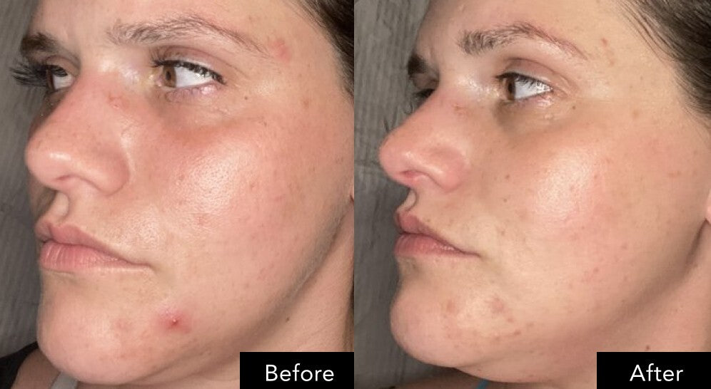 Angled views of a face shown next to each other, highlighting differences in surface appearance