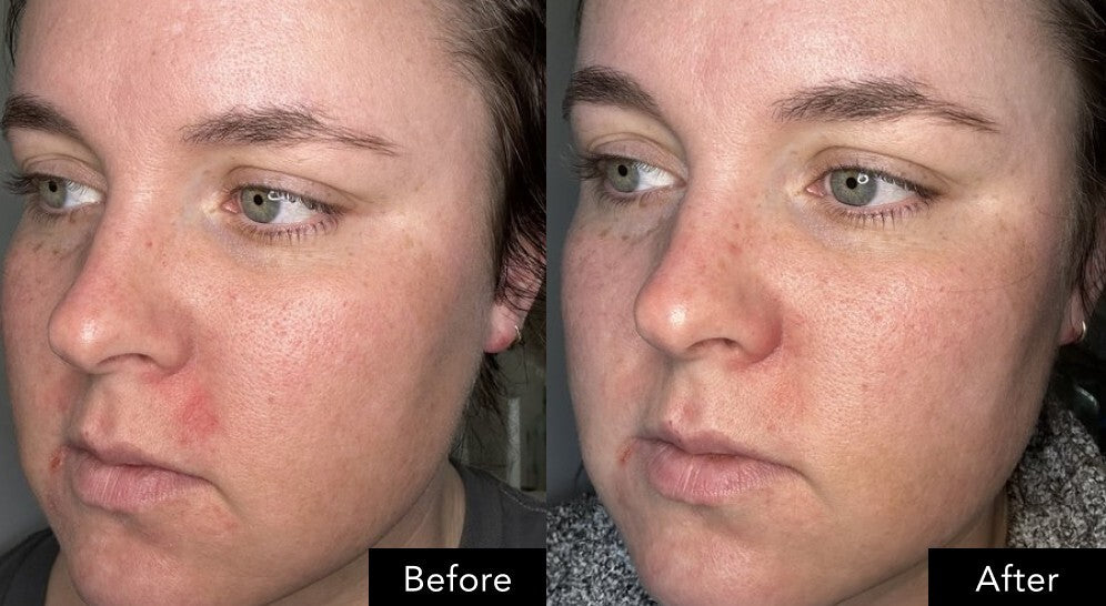 Side‑by‑side facial close‑ups showing a comparison of skin appearance before and after use