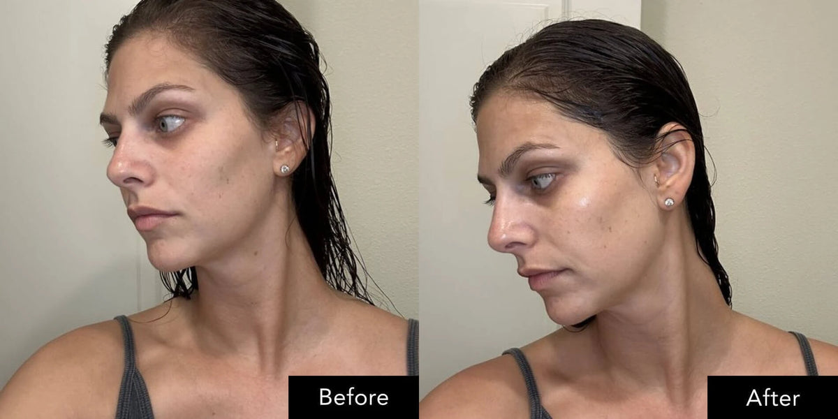 Angled facial comparison image showing appearance before and after use of SK‑II skincare products.