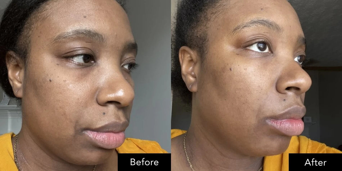 Side profile face images displayed before and after following an SK‑II anti‑aging set routine.
