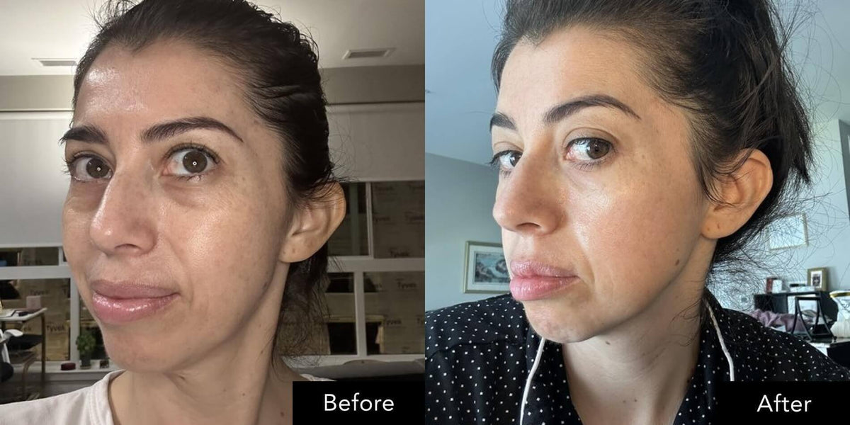 Before and after facial appearance shown side by side using SK‑II Pitera Ultimate Aura Essentials Kit.
 